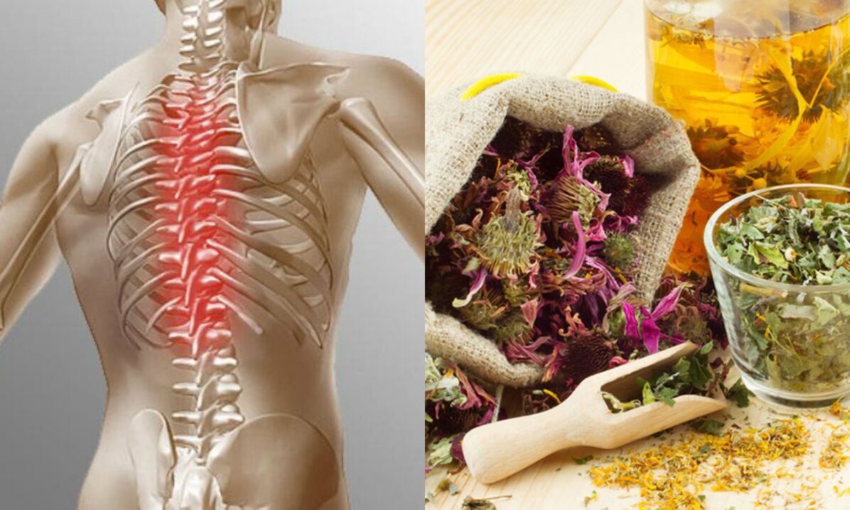 cervical osteochondrosis folk methods