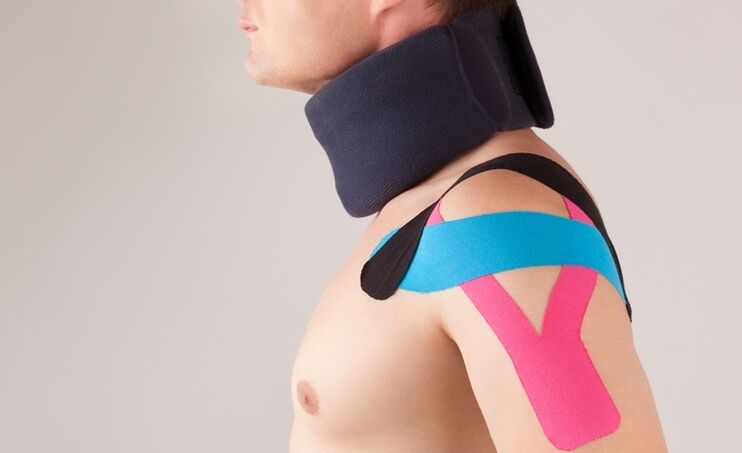 During the acute period of cervical osteochondrosis, it is necessary to wear a special collar